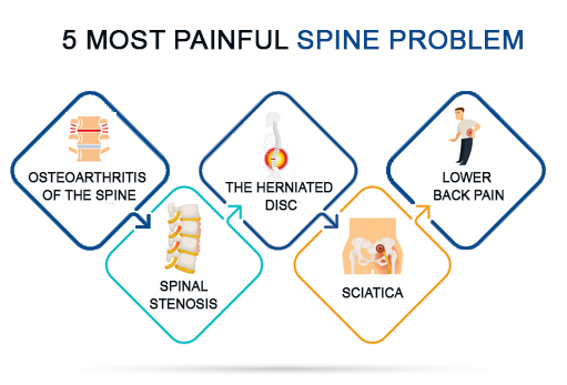 5-Most-painful-Spine-problem