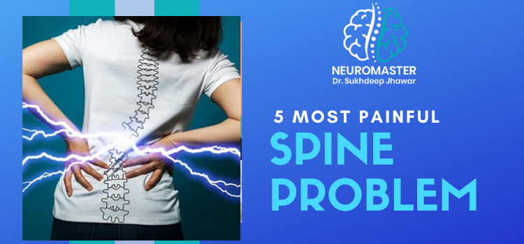 _5 Most painful Spine problem