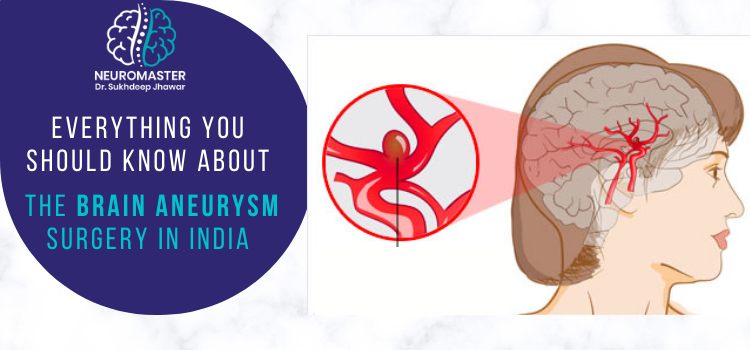 Everything you should know about the brain aneurysm surgery in India