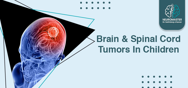 Guide on common types of brain and spinal cord tumors in children