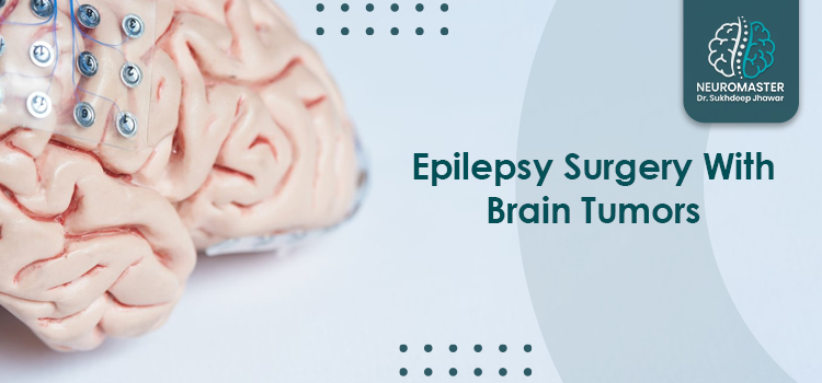 Epilepsy Surgery With Brain Tumors