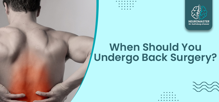 When Should You Undergo Back Surgery