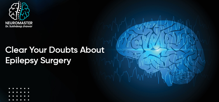 Clear Your Doubts About Epilepsy Surgery