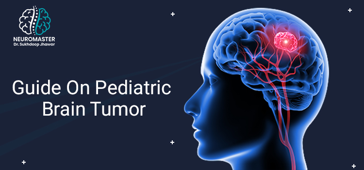 Everything you need to know about the pediatric brain tumor