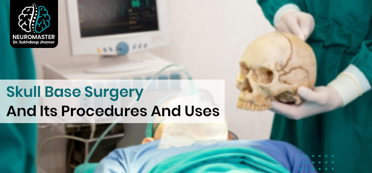 What Is The Procedure Of Skull Base Surgery, And What Does It Treat?