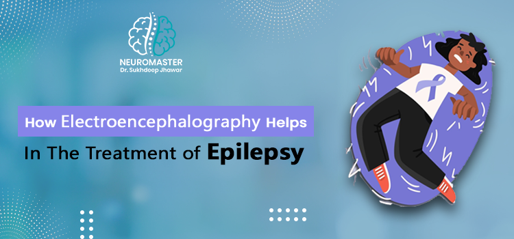 How Electroencephalography Helps In The Treatment Of Epilepsy