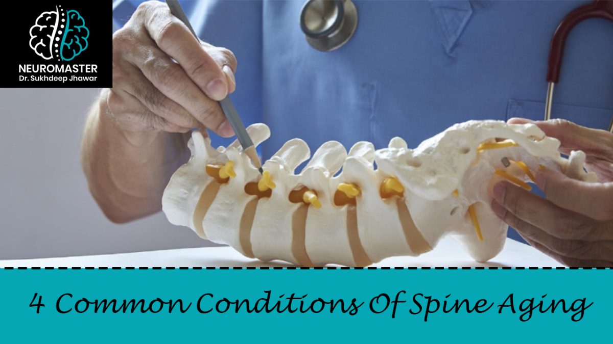 4 Common Conditions Of Spine Aging